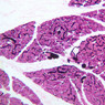 B39, Pancreas, 10x (Ink/H&E)