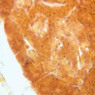 B40, Pancreas, 40x (Ag)