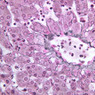 B32, Liver, 40x (Reticulin)