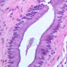 B33, Gallbladder, 40x (H&E)