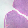 A41, Tonsil, 2.5x (H&E)
