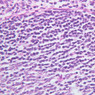A41, Tonsil, 40x (H&E)