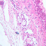 A73, Larynx, 20x (H&E)