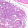 A73, Larynx, 10x (H&E)