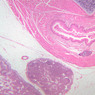 A73, Larynx, 2.5x (H&E)