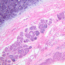 A73, Larynx, 10x (H&E)