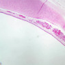 A72, Trachea, 2.5x (PAS)