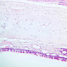 A75, Trachea, 10x (H&E)