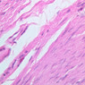 A76, Trachea, 40x (H&E)