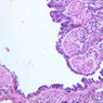 A74, Lung, 20x (H&E)