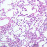 A74, Lung, 10x (H&E)