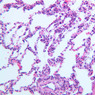 A74, Lung, 20x (H&E)