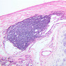 A74, Lung, 10x (H&E)