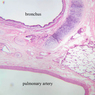 A74, Lung, 2.5x Labeled (H&E)