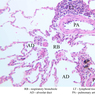 A74, Lung, 20x Labeled (H&E)