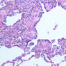 A74, Lung, 20x (H&E)