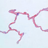 A77, Lung, 40x (Aldehyde Fuschin)