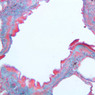28 -A77, Lung, 20x (Aldehyde Fuschin)