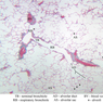 A77, Lung, 2.5x Labeled (Aldehyde Fuschin)