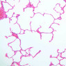 A78, Lung, 10x (H&E)