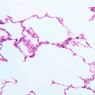 A78, Lung, 20x (H&E)