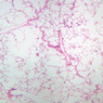 A78, Lung, 2.5x (H&E)