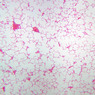 A78, Lung, 2.5x (H&E)