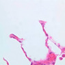 A78, Lung, 40x (H&E)