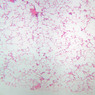 A78, Lung, 2.5x (H&E)