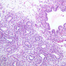 A13, Lung (Fetal), 10x (H&E)