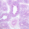 A13, Lung (Fetal), 10x (H&E)