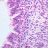 A13, Lung (Fetal), 40x (H&E)