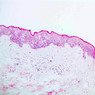 A48, Abdominal Skin (Dark), 10x (H&E)
