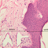 A50, Fingertip, 20x Labeled (H&E)