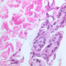 A58, Axilla, 40x (H&E)