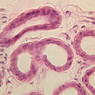 A58, Axilla, 40x (H&E)