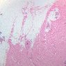 A58, Axilla, 2.5x (H&E)