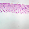 A49, Scalp (Embryo), 2.5x (H&E)
