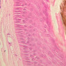 A59, Scalp, 40x (H&E)