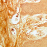 A57, Fingertip, 40x (Ag)