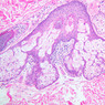 Skin and Sensory Receptors