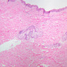 Skin and Sensory Receptors