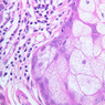 Skin and Sensory Receptors