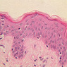 Skin and Sensory Receptors