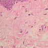 Skin and Sensory Receptors