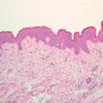 Skin and Sensory Receptors