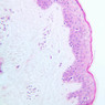 Skin and Sensory Receptors