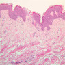 Skin and Sensory Receptors