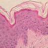 Skin and Sensory Receptors