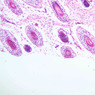 Skin and Sensory Receptors